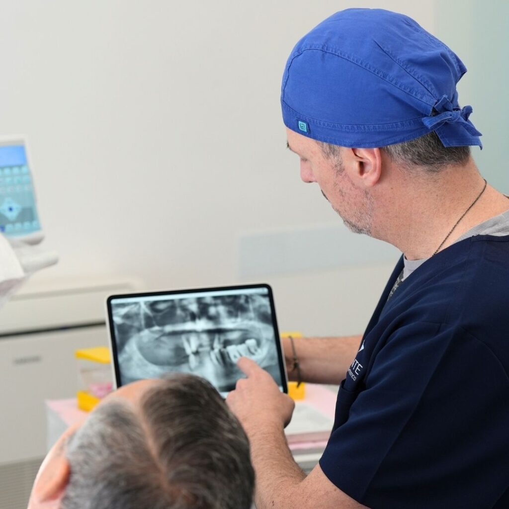 Implantologia - test 5 Impianto dentale a Taranto - Quanto Dura un Impianto Dentale - Dental Implant in Taranto